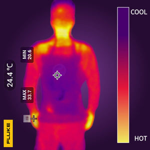 Gobi Heat thermal imaging scan showing heat distribution on a human torso
